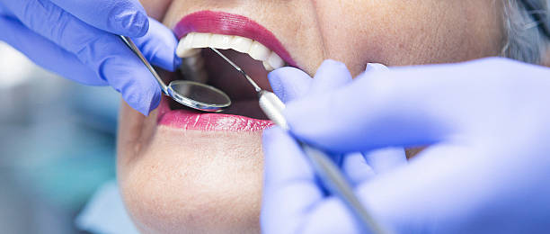 Best Same-Day Emergency Dental Services in Bellevle, IL